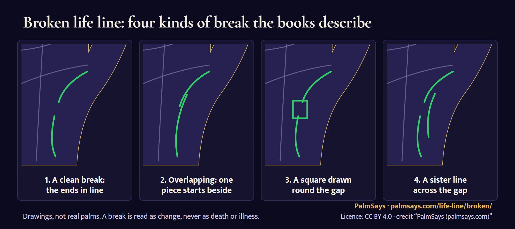 Four close-up drawings of a broken life line around the base of the thumb: 1 a clean break, a gap with both ends in line; 2 an overlapping break, the second piece starting beside the first; 3 a small square drawn round the gap; 4 a sister line running just inside the life line, across the gap.